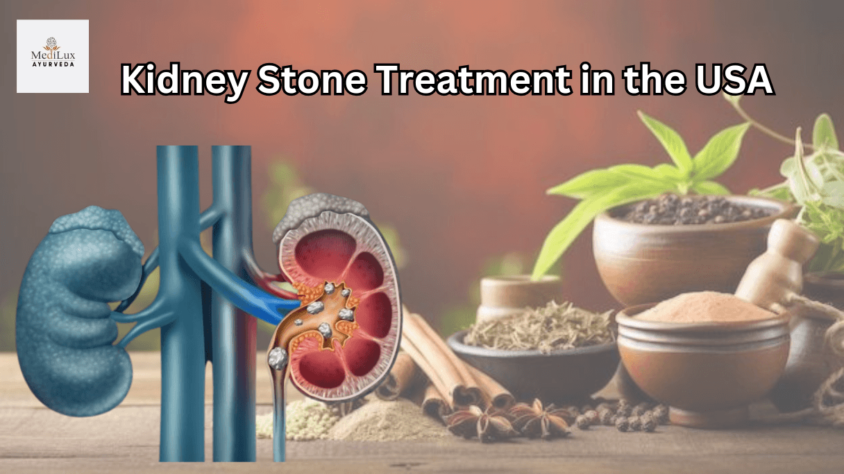 Kidney stone treatment in the USA