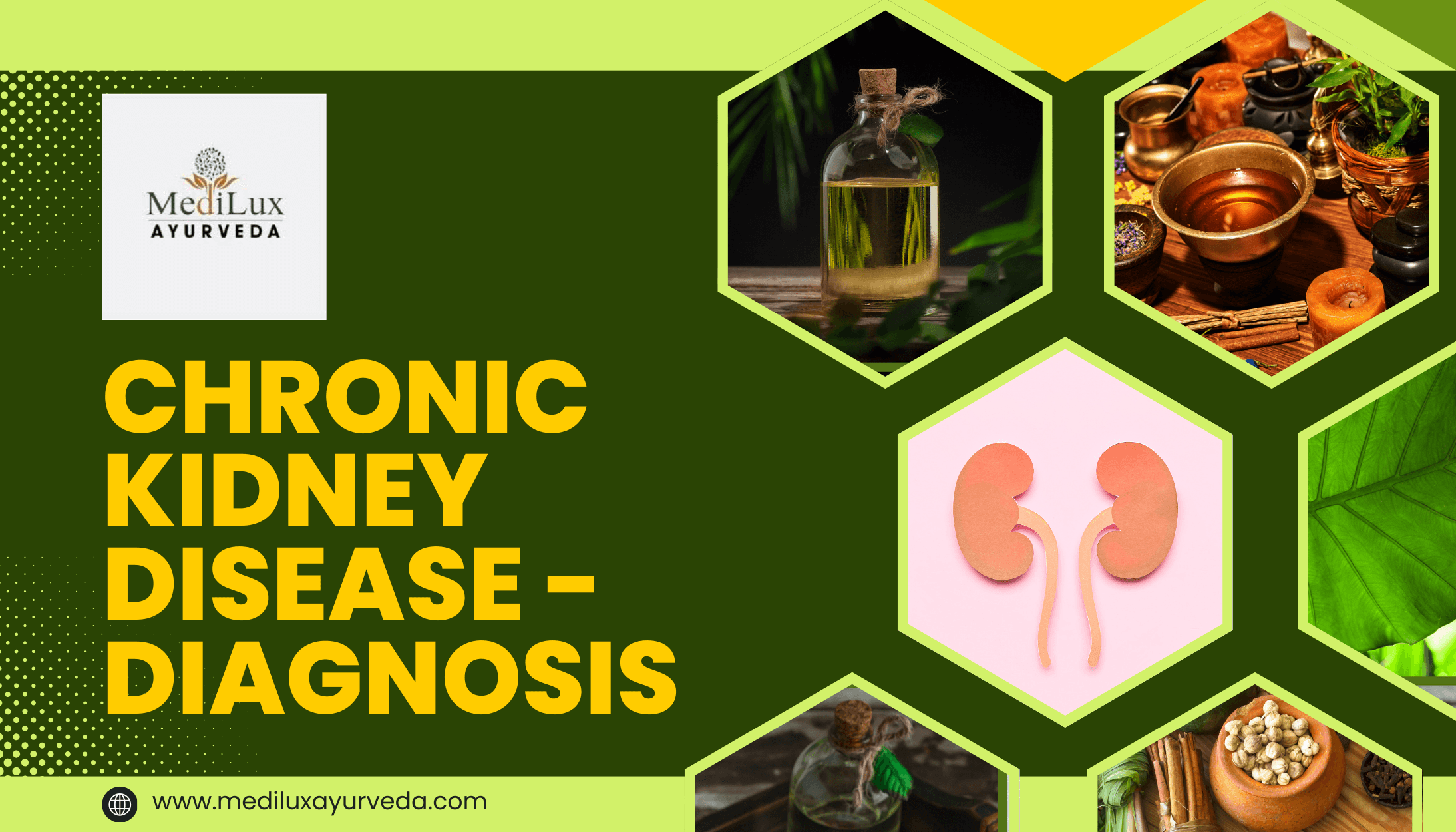 Chronic Kidney Disease Diagnosis