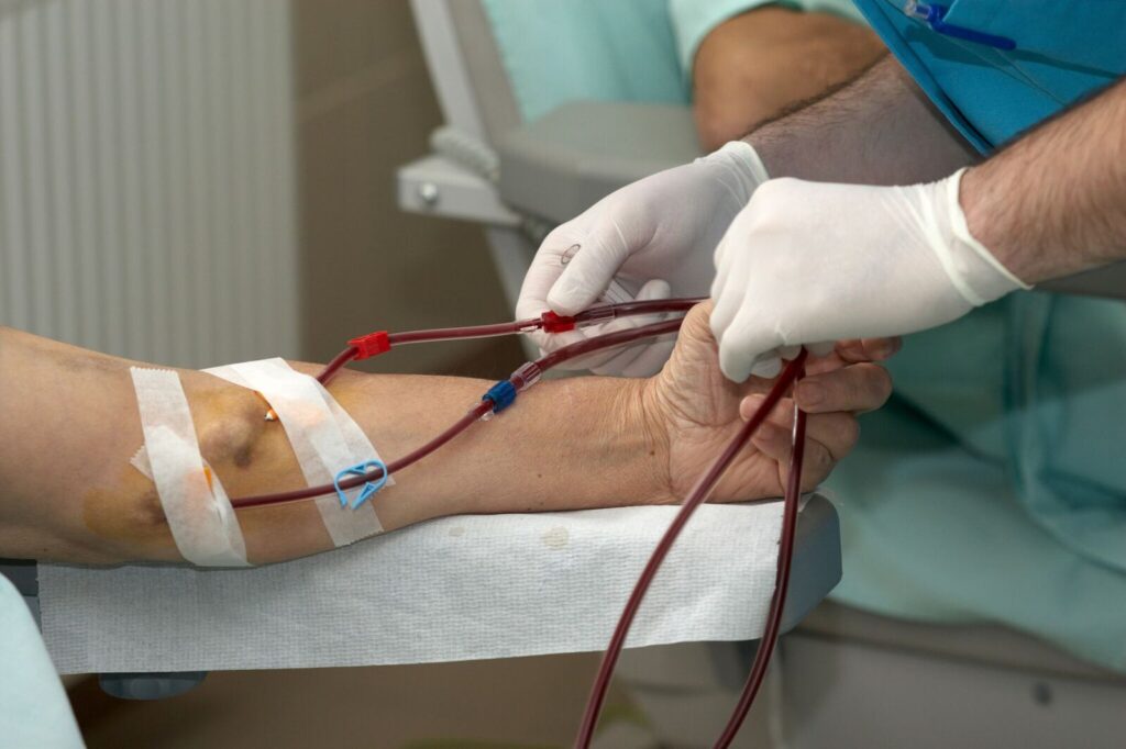 Kidney Dialysis