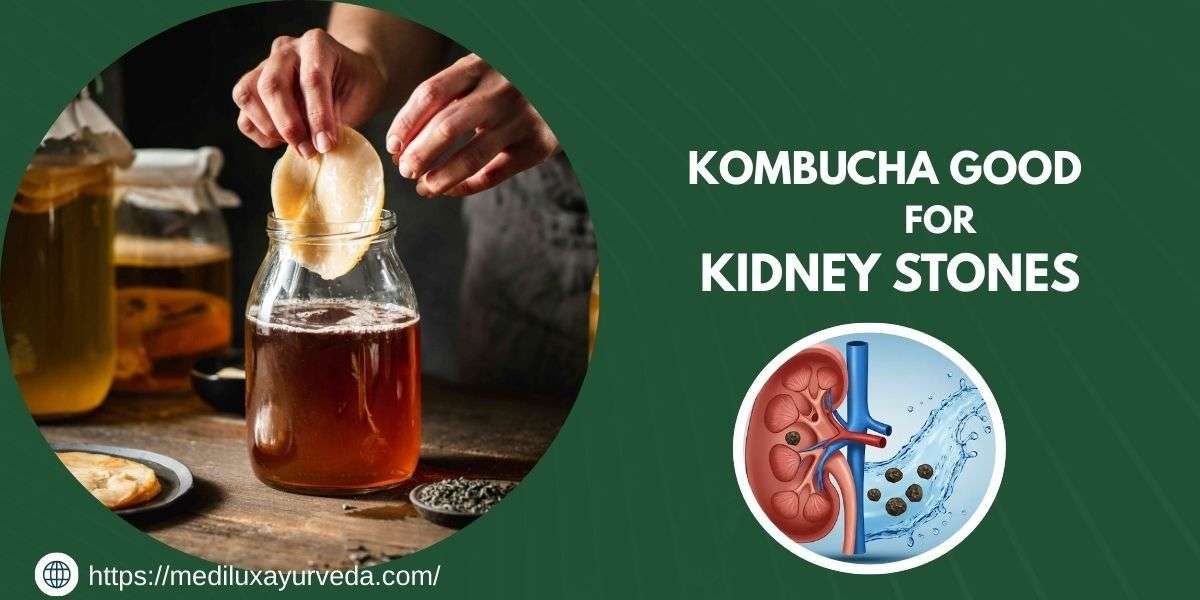 Is Kombucha Good for Kidney Stones